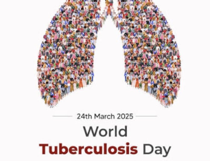 Preventable but Persistent: Why TB Still Claims Over 1 Million Lives Annually