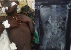 ‎Horror in Uganda: Woman Accused of Forcing Child to Swallow Needles