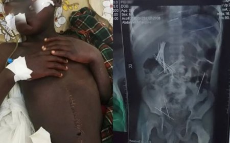 ‎Horror in Uganda: Woman Accused of Forcing Child to Swallow Needles