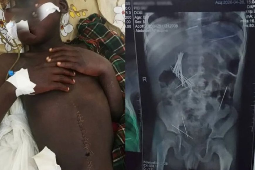 ‎Horror in Uganda: Woman Accused of Forcing Child to Swallow Needles